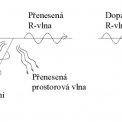 Obr. 1 – Schéma R-vlny při dopadu na rozhraní materiálu
